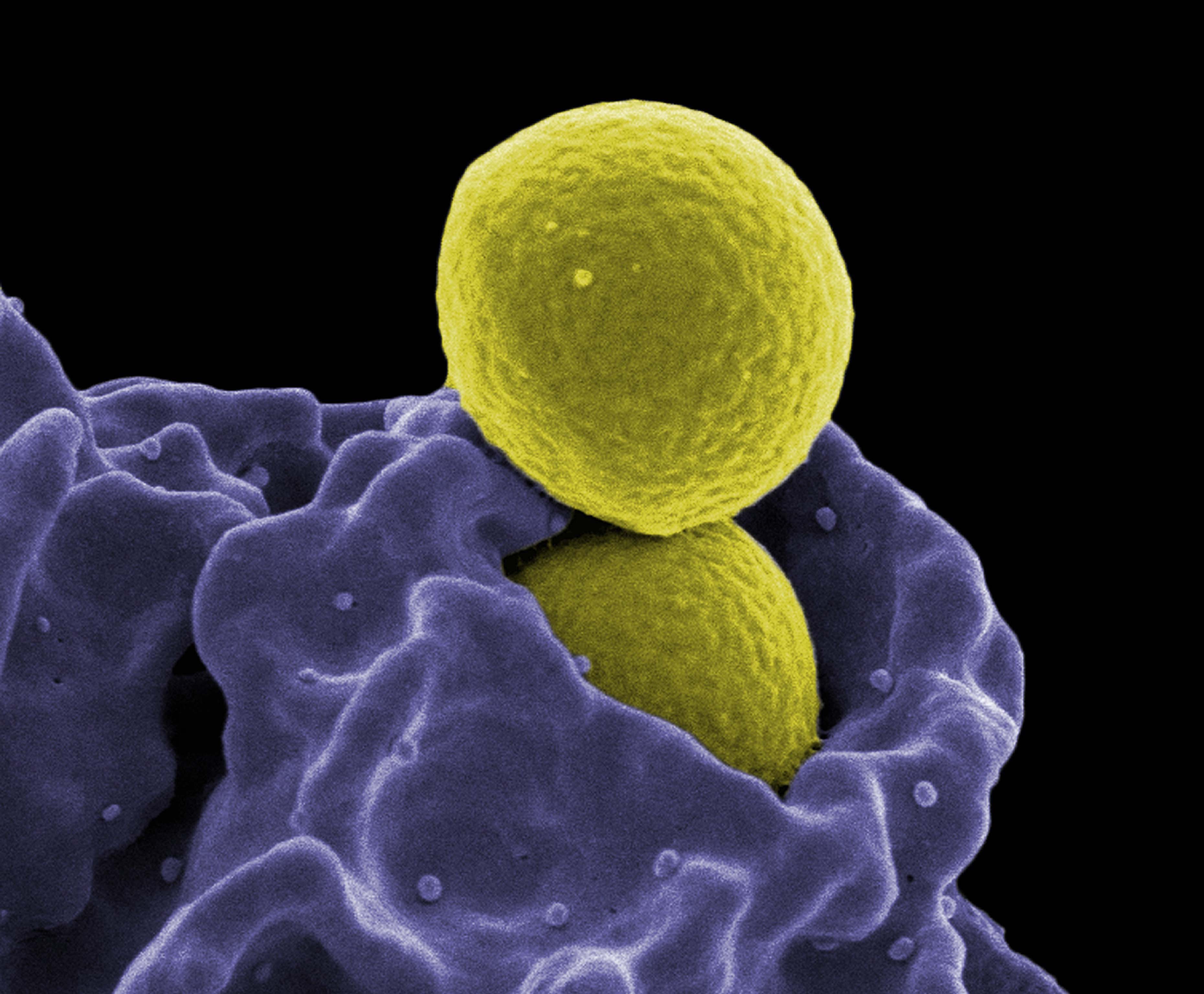 What is Staphylococcus Aureus?