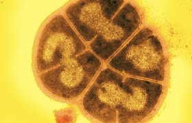 Deinococcus Radiodurans: The World's Toughest Bacterium. A Review