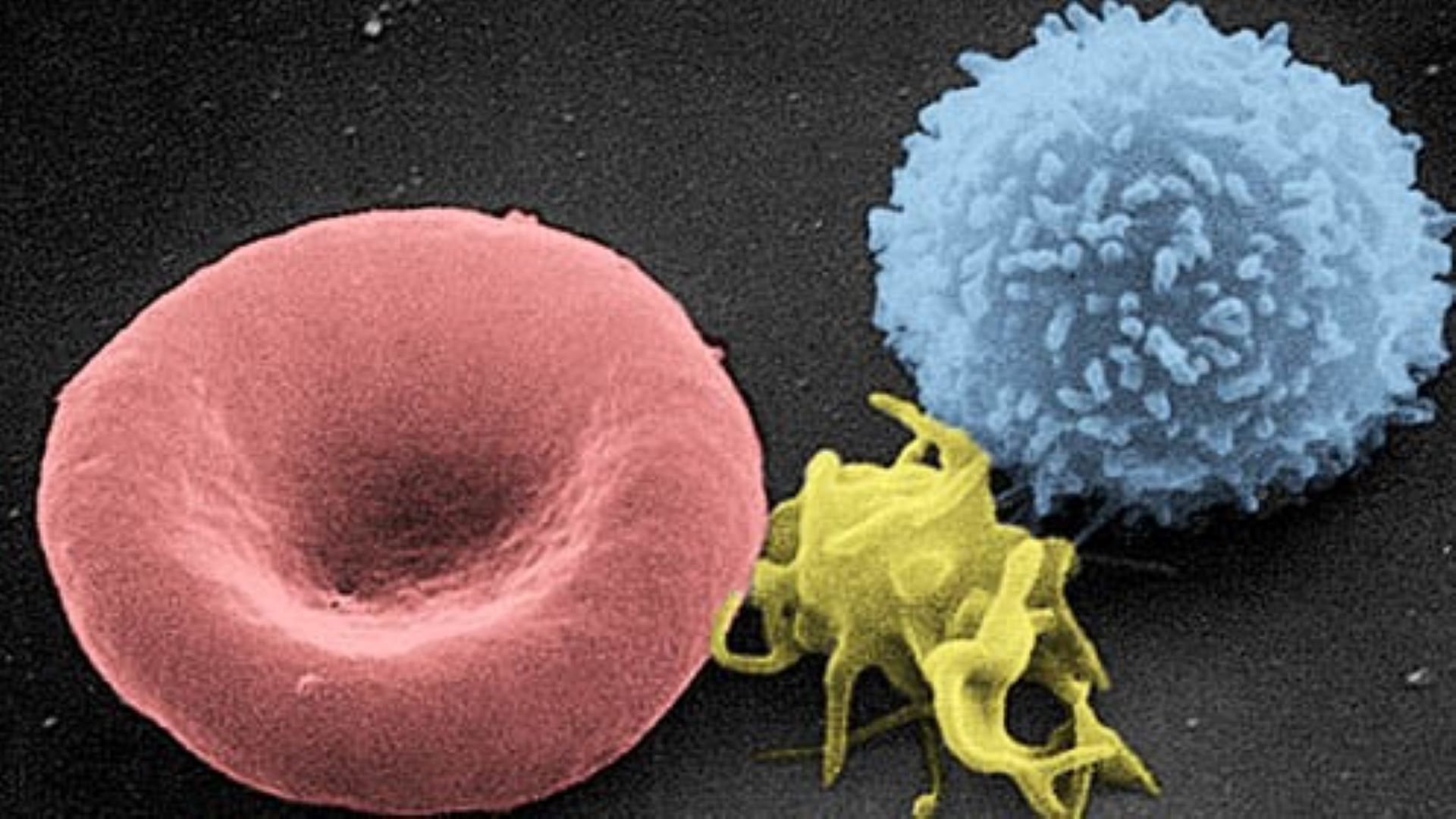Coronavirus Makes Platelets Hyperactive Micropia